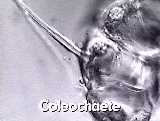 Coleochaete scutata