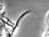 Acetobacter cellulose